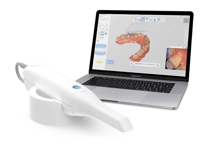 Escáner intraoral 3D utilizado por la clínica